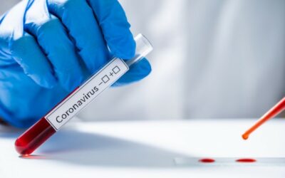 Johnson & Johnson empezará a probar vacuna de la COVID-19 en humanos en julio