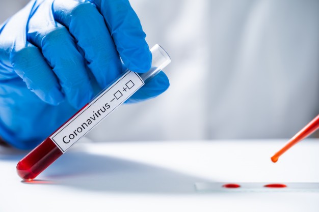 Giammattei endurece medidas para reducir casos de coronavirus en Guatemala